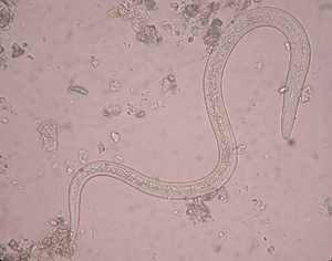 The Power Of Beneficial Nematodes